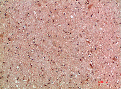Anti-KMT2A antibody (3850-3900 aa) (STJ98732) – Figure 1 of 1