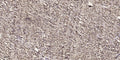 Anti-Acetyl-RELA-K314/315 antibody (STJ98905) – Figure 1 of 1