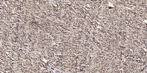 Anti-Acetyl-RELA-K314/315 antibody (STJ98905) – Figure 1 of 1
