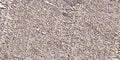Anti-Acetyl-RELA-K314/315 antibody (STJ98906) – Figure 1 of 1