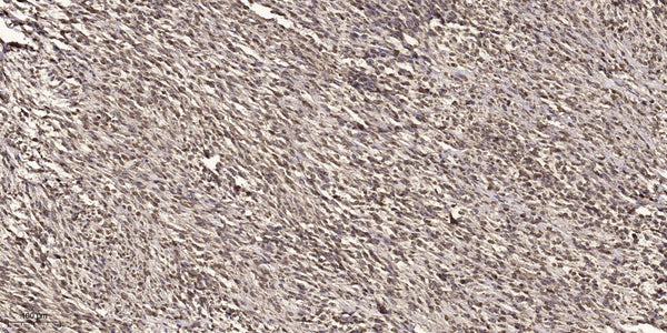 Anti-Acetyl-RELA-K314/315 antibody (STJ98906) – Figure 1 of 1