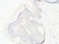 Anti-COL1A1 antibody (STJ98915) – Figure 1 of 1