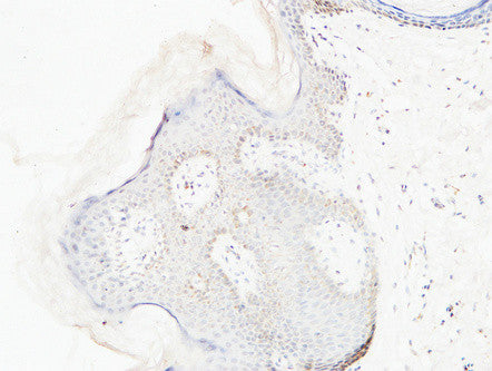 Anti-COL1A1 antibody (STJ98915) – Figure 1 of 1