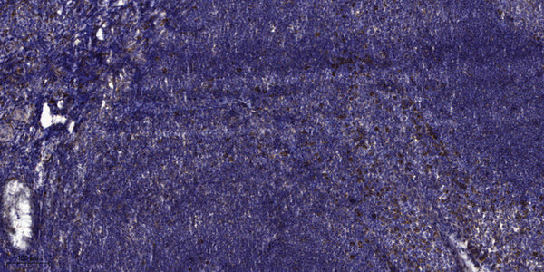 Anti-COL2A1 antibody (STJ98944) – Figure 1 of 1