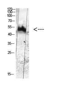 Anti-Phospho-MDM2-Tyr394 antibody (STJ98946) – Figure 1 of 1