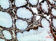 Anti-HSPA5 antibody (505-570 aa) (STJ98969) – Figure 1 of 1
