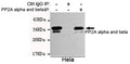 Anti-PPP2CB antibody [2G2-H6-G11-E8] (STJ99088) – Figure 1 of 1