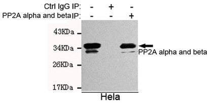 Anti-PPP2CB antibody [2G2-H6-G11-E8] (STJ99088) – Figure 1 of 1