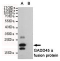 Anti-GADD45A antibody [6C3-G3-E9] (STJ99242) – Figure 1 of 1