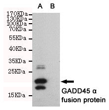 Anti-GADD45A antibody [6C3-G3-E9] (STJ99242) – Figure 1 of 1
