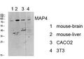 Anti-MAP4 antibody (STJ99615) – Figure 1 of 1