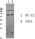 Anti-FOXO3 antibody (STJ99616) – Figure 1 of 1