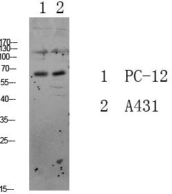 Anti-FOXO3 antibody (STJ99616) – Figure 1 of 1