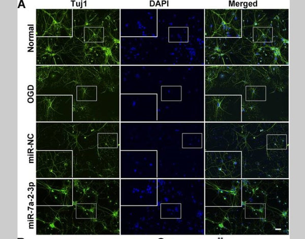 Goat Anti-Rabbit IgG Heavy & Light Chain antibody {FITC} (STJ99668) – Figure 1 of 1
