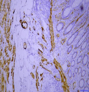Anti-smooth muscle Myosin heavy chain 11 antibody [SM5002] (STJA0005002) – Figure 1 of 1