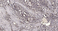 Anti-Cleaved-ACAN-Ala17 antibody (16-17) (STJA0005818) – Figure 1 of 1