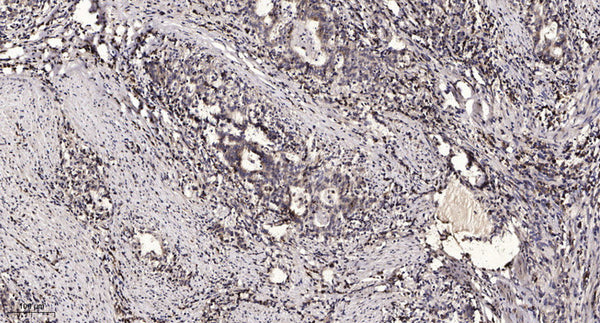 Anti-Cleaved-ACAN-Ala17 antibody (16-17) (STJA0005818) – Figure 1 of 1
