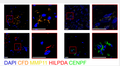 Anti-Cleaved-CFD-Ile26 antibody (25-26) (STJA0005849) – Figure 1 of 1