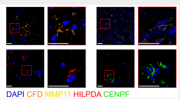 Anti-Cleaved-CFD-Ile26 antibody (25-26) (STJA0005849) – Figure 1 of 1