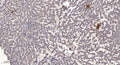 Anti-Cleaved-KLK14-Ile25 antibody (24-25) (STJA0005882) - Figure 1 of 1