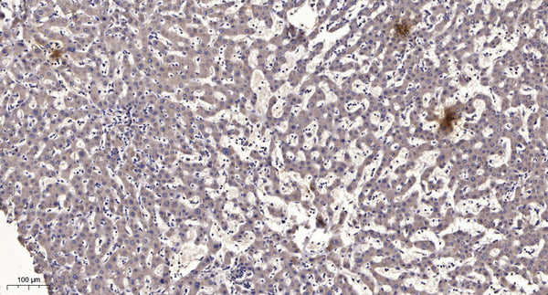 Anti-Cleaved-KLK14-Ile25 antibody (24-25) (STJA0005882) - Figure 1 of 1