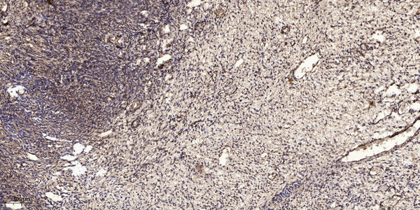 Anti-Cleaved-KLK6-Leu22 antibody (21-22) (STJA0005885) – Figure 1 of 1