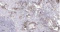 Anti-Cleaved-MMP26-Thr90 antibody (89-90) (STJA0005893) – Figure 1 of 1