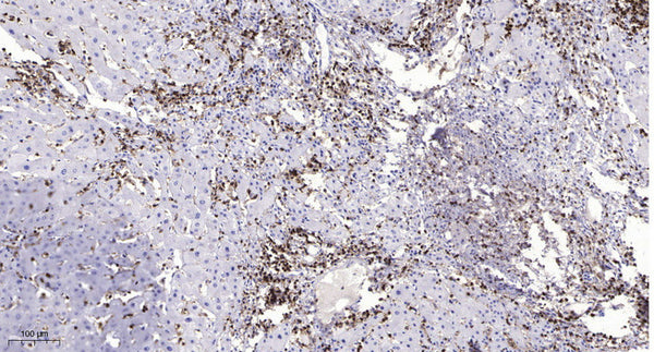 Anti-Cleaved-MMP26-Thr90 antibody (89-90) (STJA0005893) – Figure 1 of 1