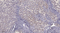 Anti-Cleaved-NFKB1-Gly433 antibody (433-434) (STJA0005901) – Figure 1 of 1