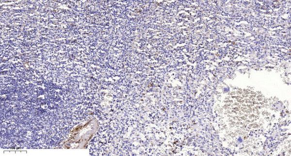 Anti-Acetyl-KLF13-Lys166 antibody (STJA0005973) – Figure 1 of 1