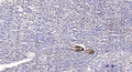 Anti-Acetyl-KPNA2-Lys22 antibody (STJA0005974) – Figure 1 of 1