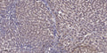 Anti-Acetyl-MYOD1-Lys99/K102 antibody (STJA0005981) – Figure 1 of 1