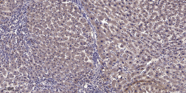 Anti-Acetyl-MYOD1-Lys99/K102 antibody (STJA0005981) – Figure 1 of 1