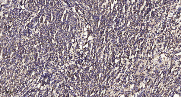 Anti-Pan-Acetyl-MYH1-Lys505 antibody (STJA0005983) – Figure 1 of 1