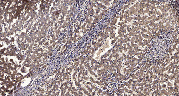 Anti-Acetyl-SP3-Lys551 antibody (STJA0005991) – Figure 1 of 1