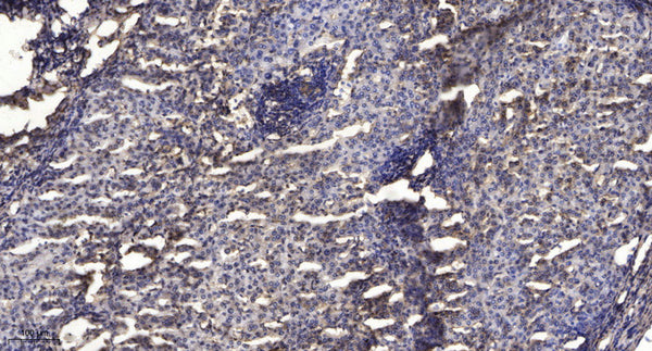 Anti-Acetyl-STAT1-Lys410/K413 antibody (STJA0005994) – Figure 1 of 1