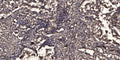 Anti-Acetyl-STAT2-Lys384 antibody (STJA0005995) – Figure 1 of 1