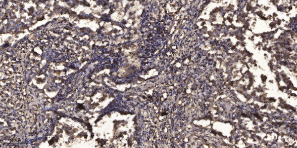 Anti-Acetyl-STAT2-Lys384 antibody (STJA0005995) – Figure 1 of 1