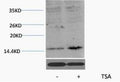 Anti-Acetyl-HIST1H3A/HIST1H3B/HIST1H3C/HIST1H3D/HIST1H3E/HIST1H3F/HIST1H3G/HIST1H3H/HIST1H3I/HIST1H3J/HIST2H3 – Figure 1 of 1