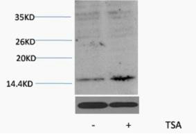 Anti-Acetyl-HIST1H3A/HIST1H3B/HIST1H3C/HIST1H3D/HIST1H3E/HIST1H3F/HIST1H3G/HIST1H3H/HIST1H3I/HIST1H3J/HIST2H3 – Figure 1 of 1