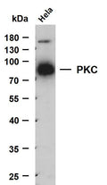 Anti-PRKCA antibody (450-550) [PTR1190] (STJA0006229) – Figure 1 of 1