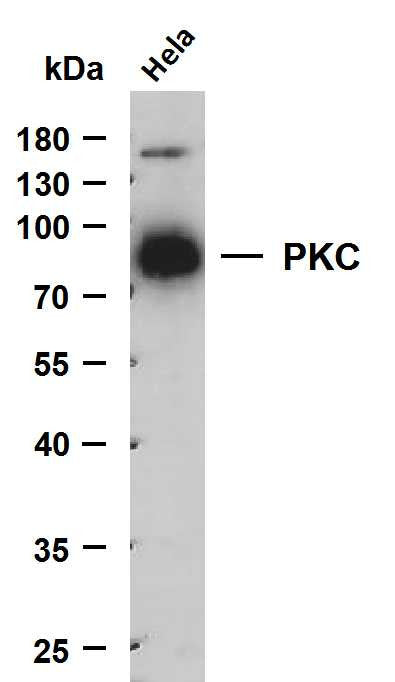 Anti-PRKCA antibody (450-550) [PTR1190] (STJA0006229) – Figure 1 of 1