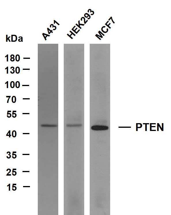 Anti-PTEN antibody (300-403) [PT2124] (STJA0006236) – Figure 1 of 1