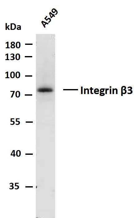 Anti-ITGB3 antibody (700-788) [PTR2555] (STJA0006262) – Figure 1 of 1