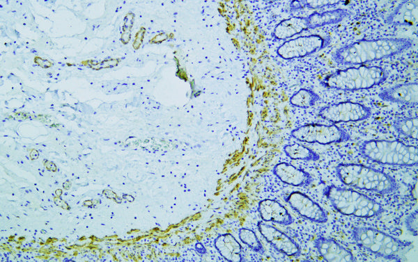 Anti-SMTN antibody (700-800) [PTR1305] (STJA0006269) – Figure 1 of 1