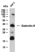 Anti-LGALS9 antibody (1-100) [PTR1201] (STJA0006277) – Figure 1 of 1