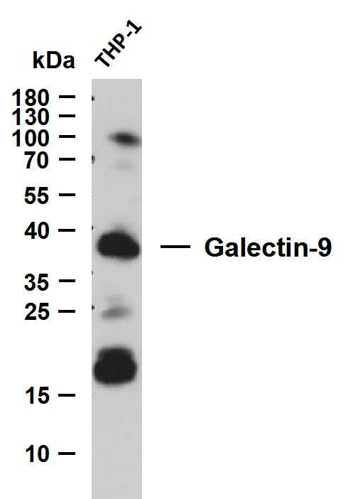 Anti-LGALS9 antibody (1-100) [PTR1201] (STJA0006277) – Figure 1 of 1