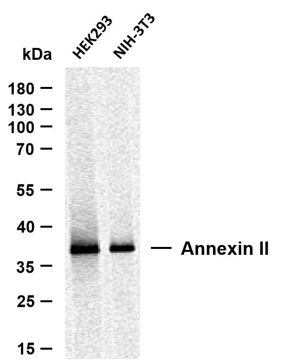 Anti-ANXA2 antibody (100-200) [PTR1321] (STJA0006280) – Figure 1 of 1