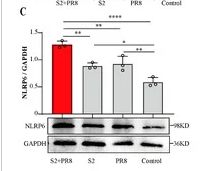 Anti-NLRP6 antibody (20-50) (STJA0006423) – Figure 1 of 1