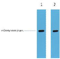 Anti-mCherry-Tag antibody (STJA0006701) – Figure 1 of 1
